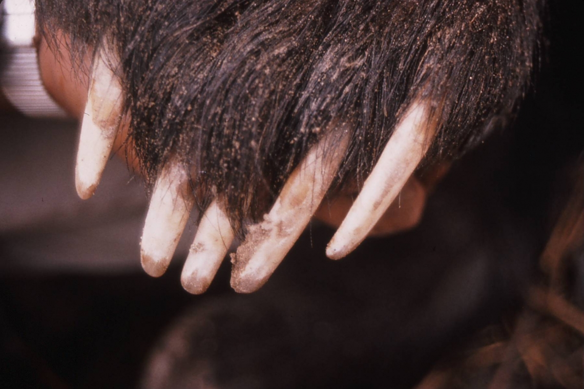 Sloth bear_M ursinus_Nepal_straight front claws_D Garshelis